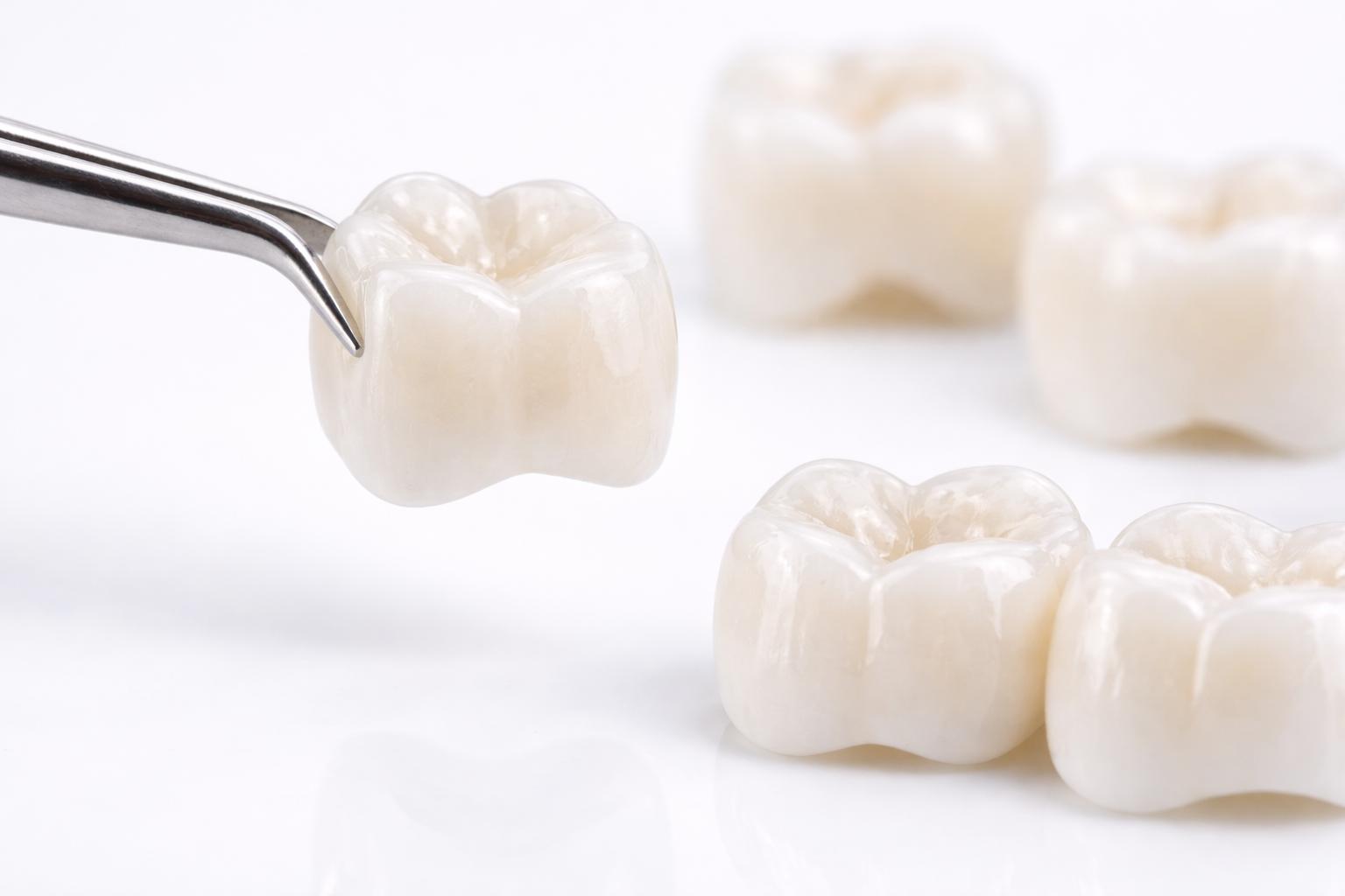 Coronas dentales con forma anatómica y acabado natural