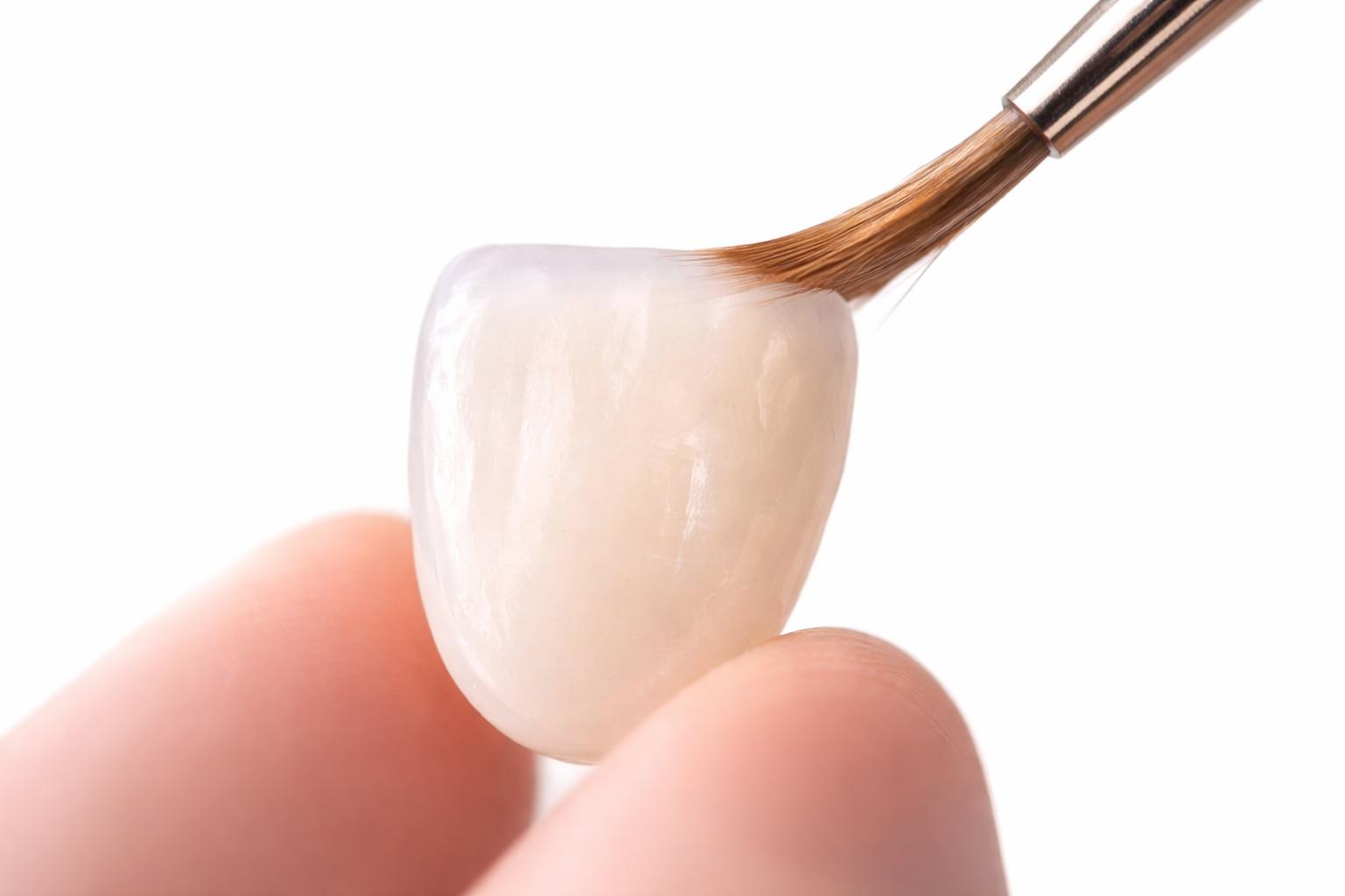 Diseño de sonrisa con armonía dental natural