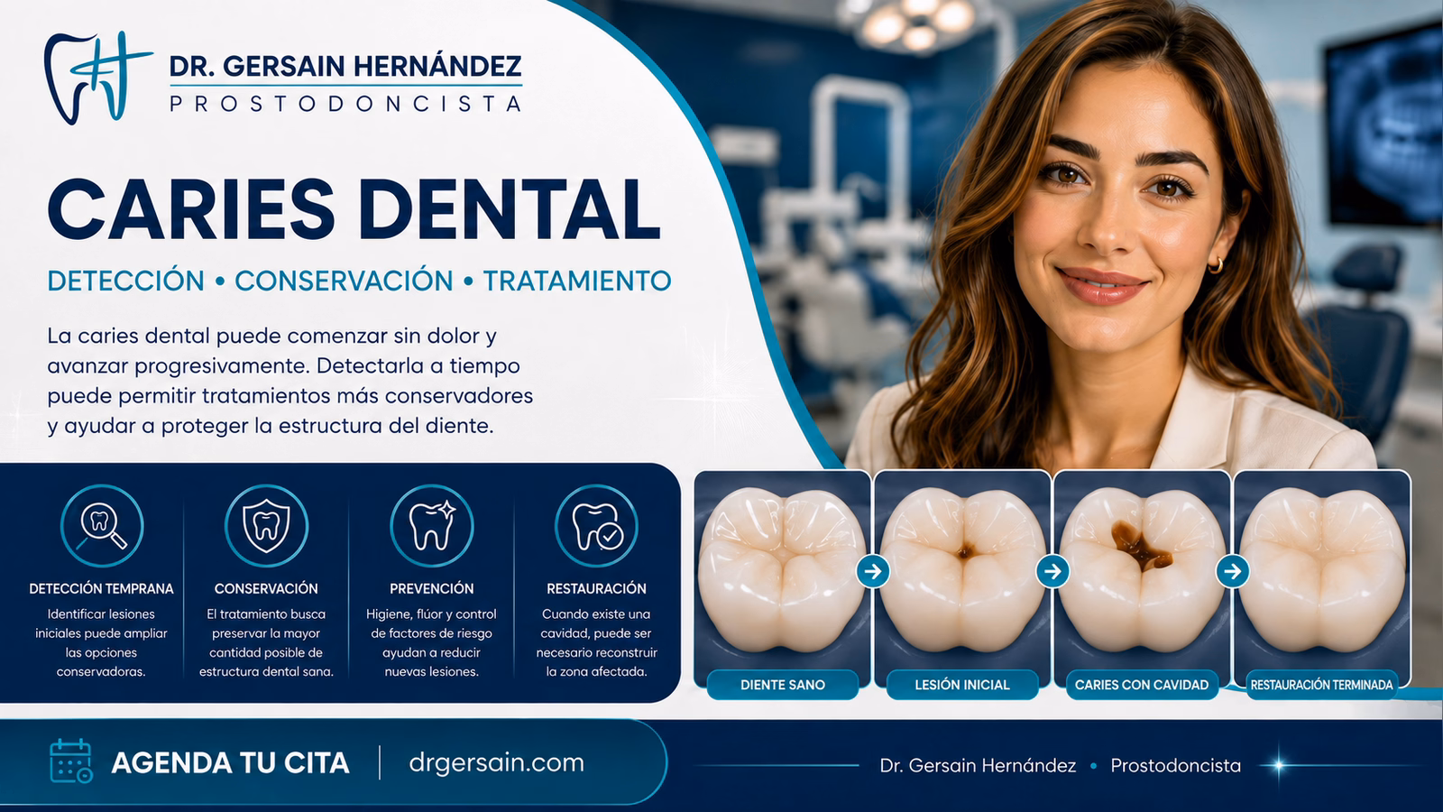 Caries dental: cómo progresa y qué tratamiento puede necesitar un diente