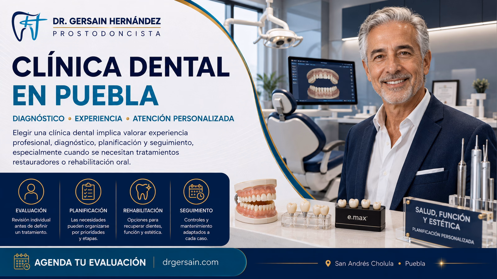 Clínica dental en Puebla: qué buscar antes de elegir dónde tratarte