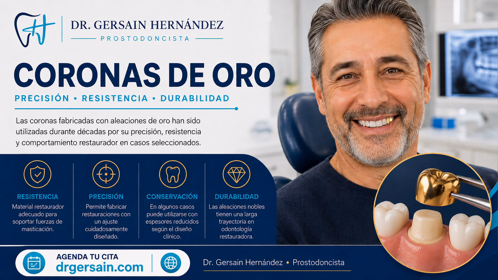 Coronas de oro: por qué este material clásico sigue teniendo interés restaurador