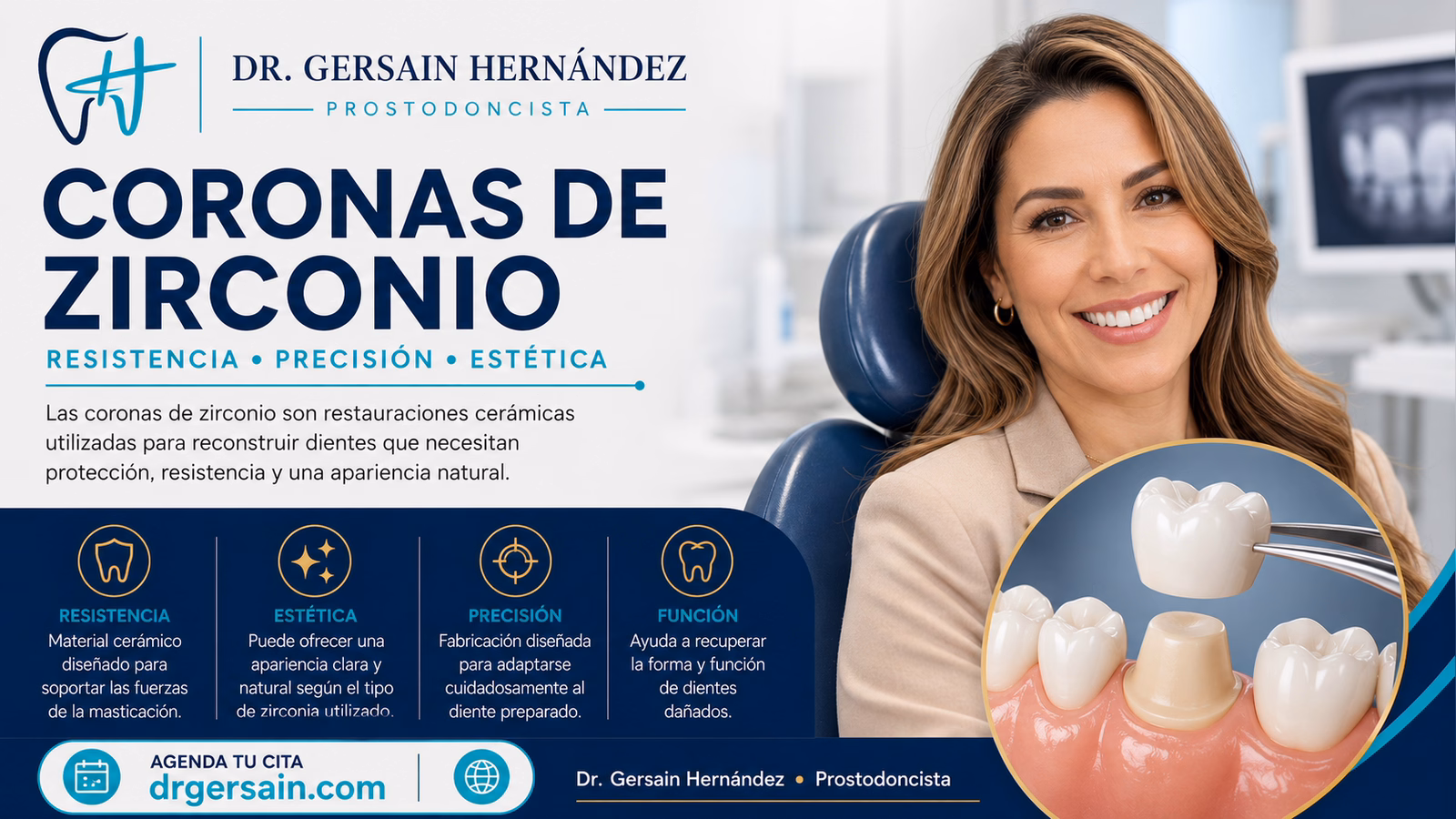 Coronas de zirconio: resistencia, estética y cuándo pueden ser una opción