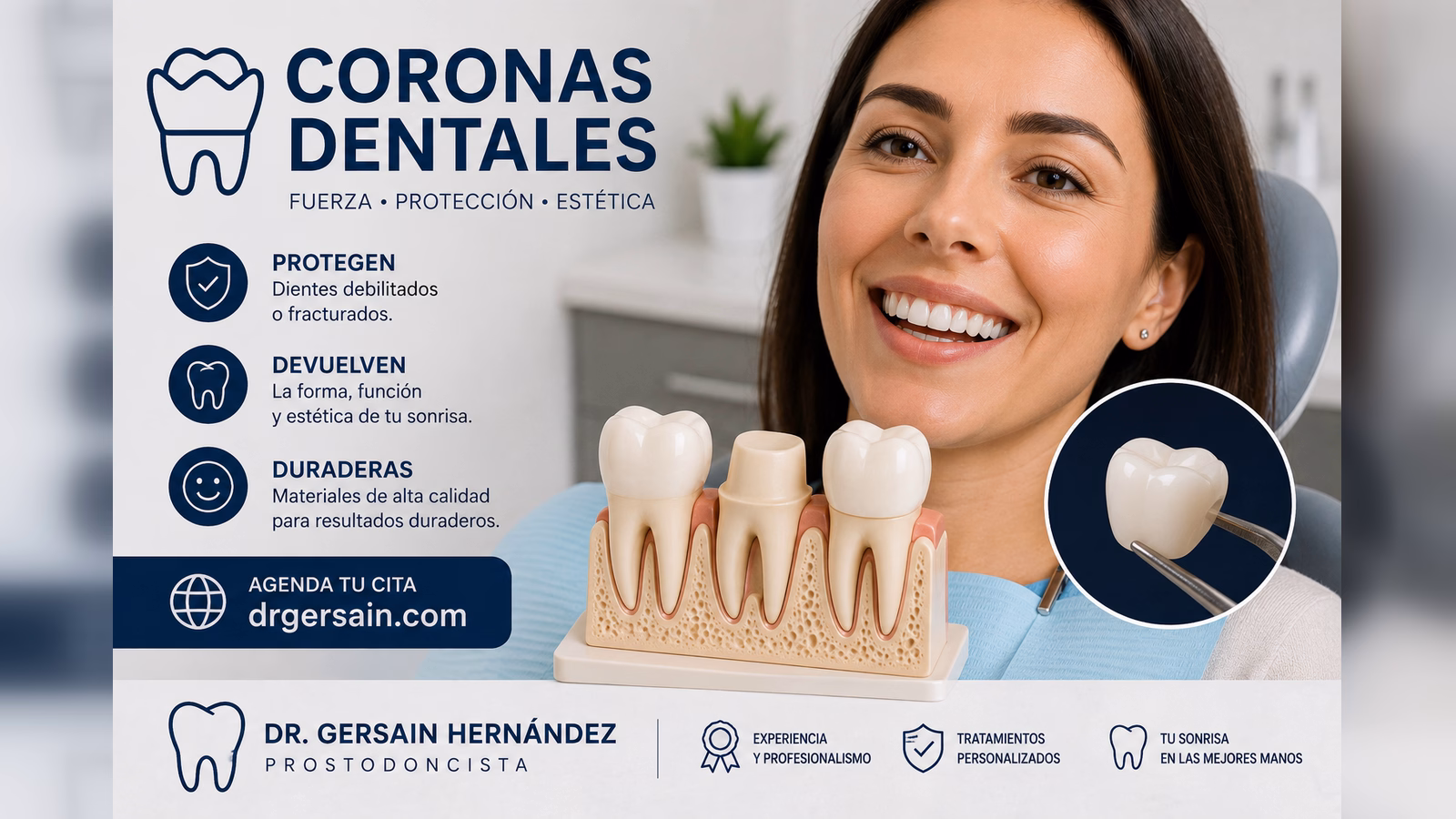 Coronas dentales: cuándo un diente necesita protección completa