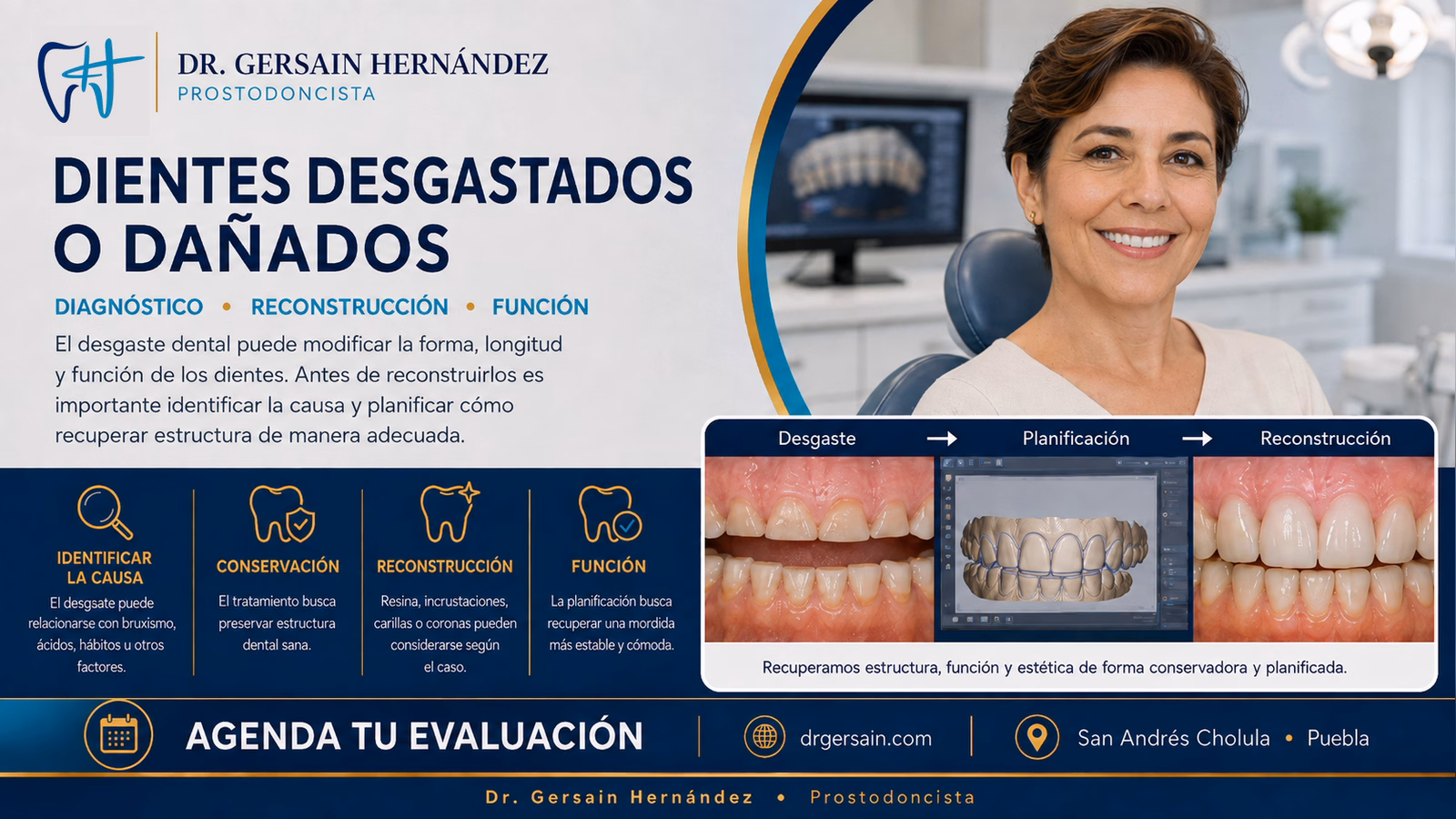 Dientes desgastados o dañados: cómo recuperar forma y función