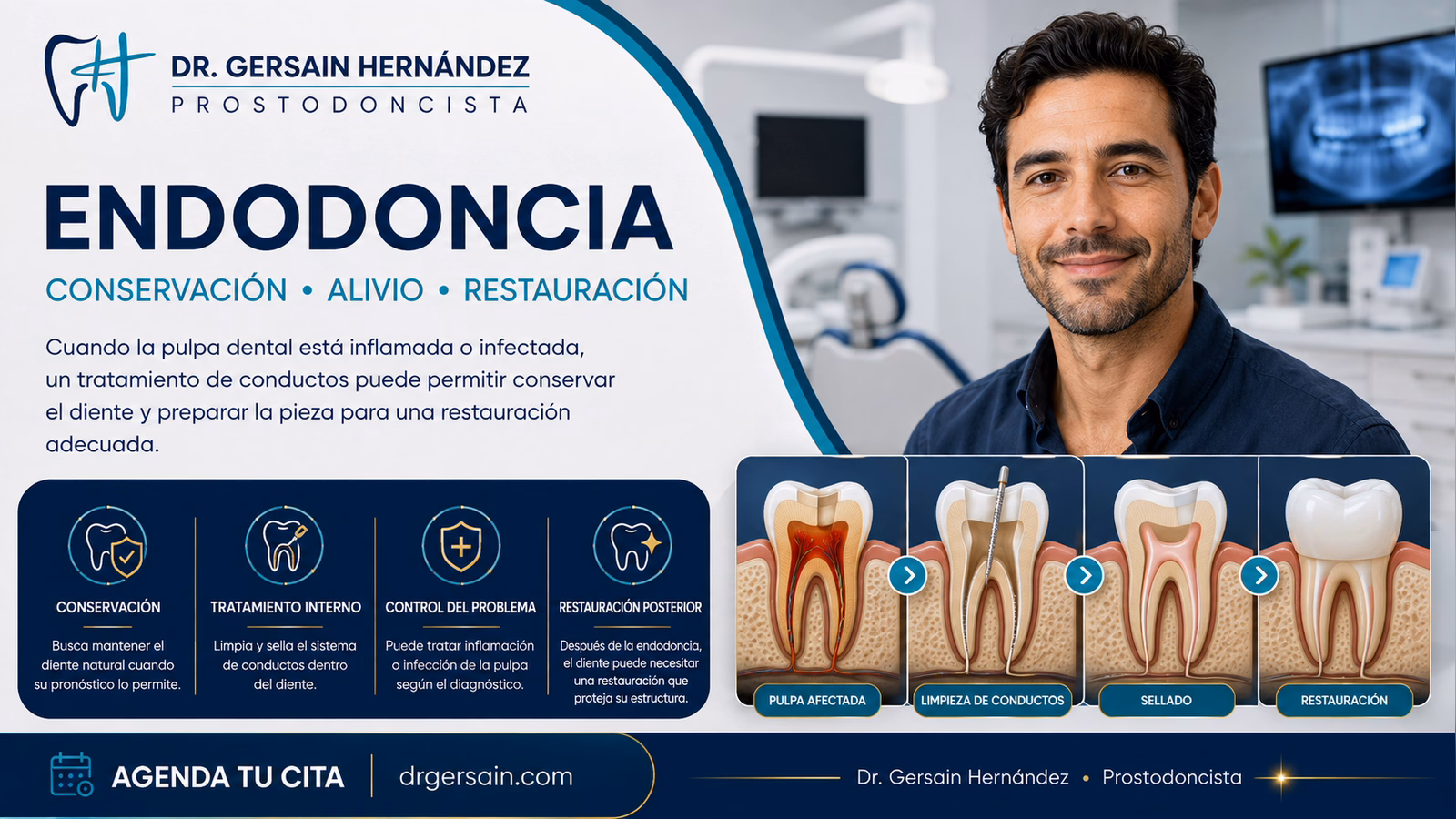 Endodoncia: cuándo un diente puede necesitar tratamiento de conductos