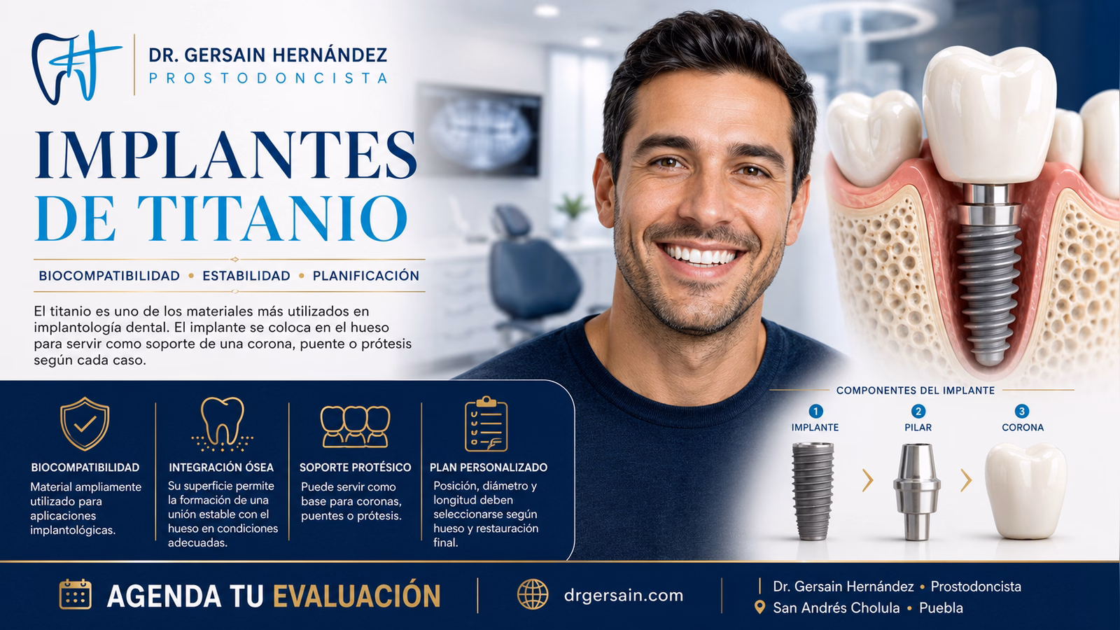 Implantes de titanio: por qué este material se usa para sustituir raíces dentales