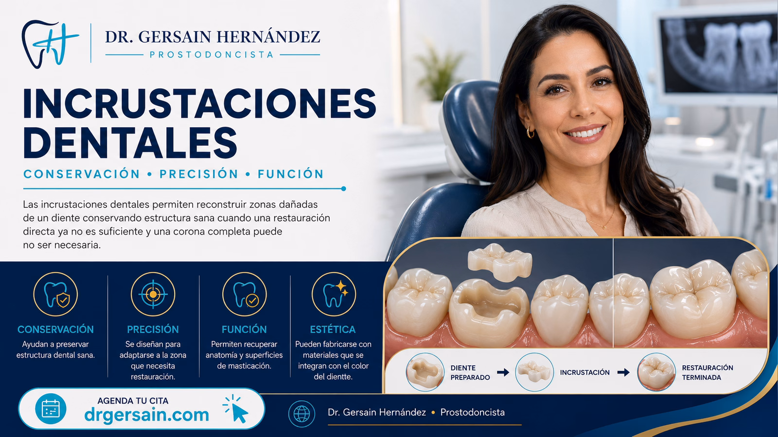 Incrustaciones dentales: una alternativa entre resina y corona
