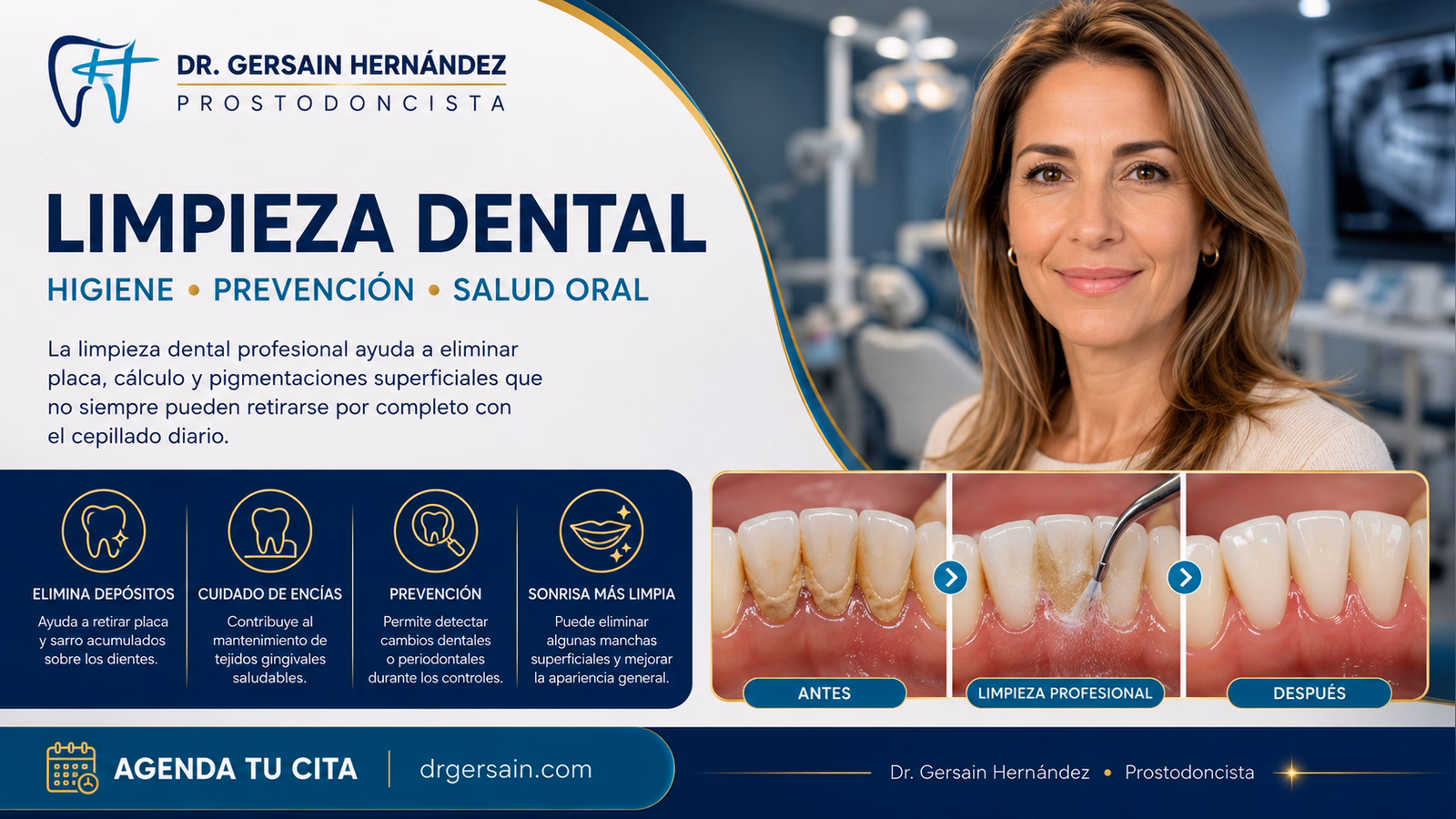 Limpieza dental: qué elimina una profilaxis y cuándo se necesita algo más
