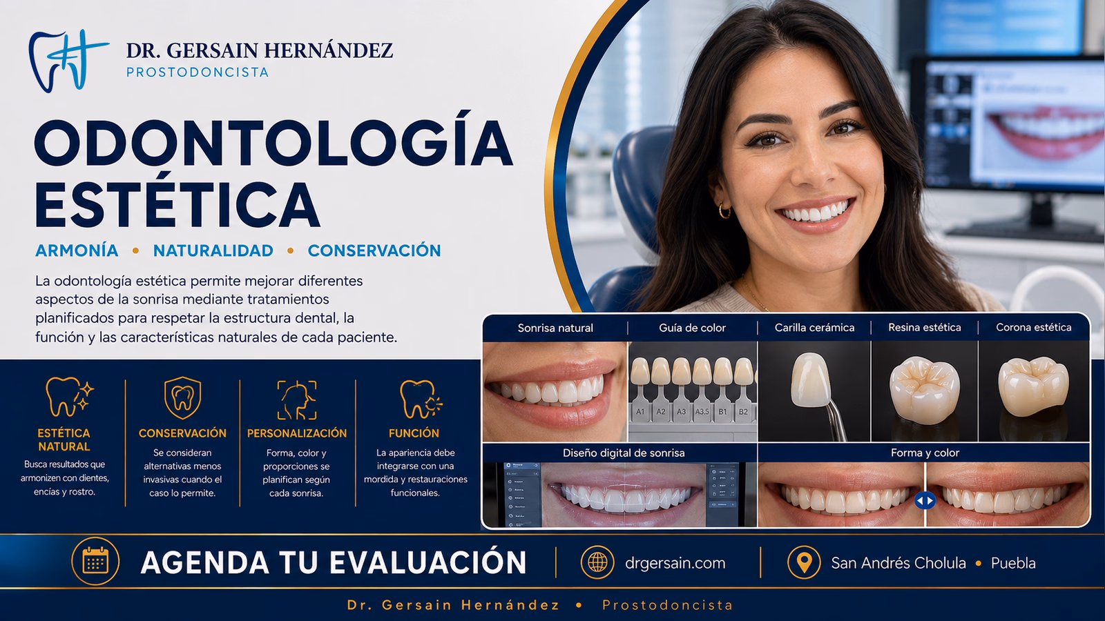 Odontología estética: opciones para mejorar la sonrisa conservando función