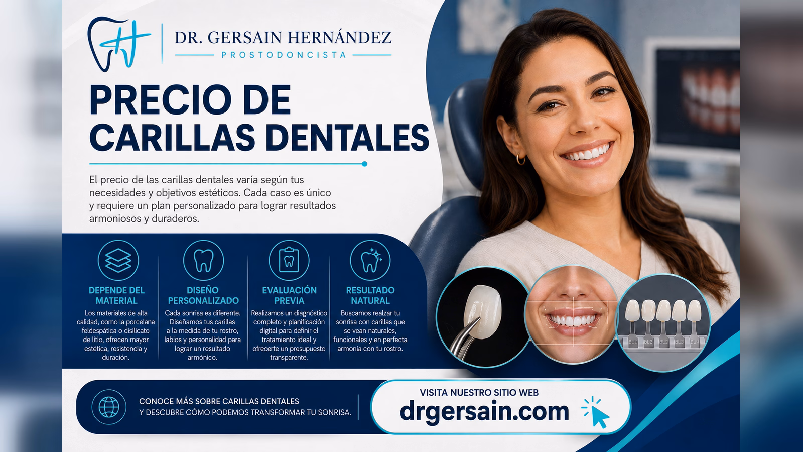 Precio de carillas dentales: qué determina el costo real de un diseño de sonrisa