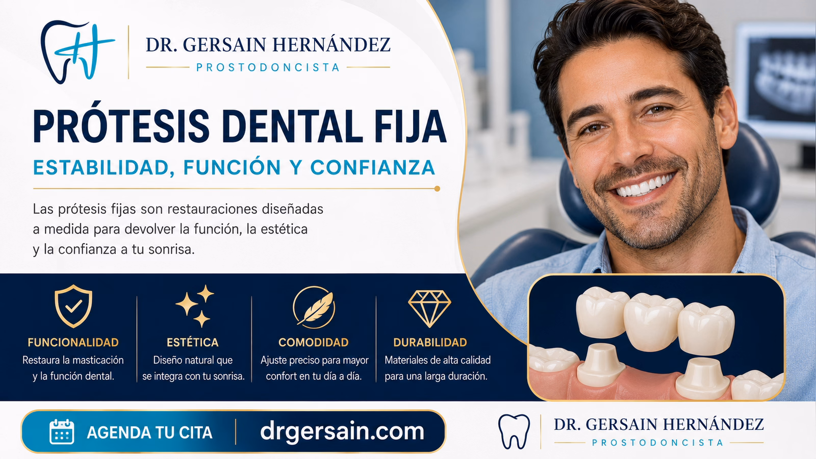 Prótesis dental fija: puentes, coronas e implantes para dientes que no se retiran