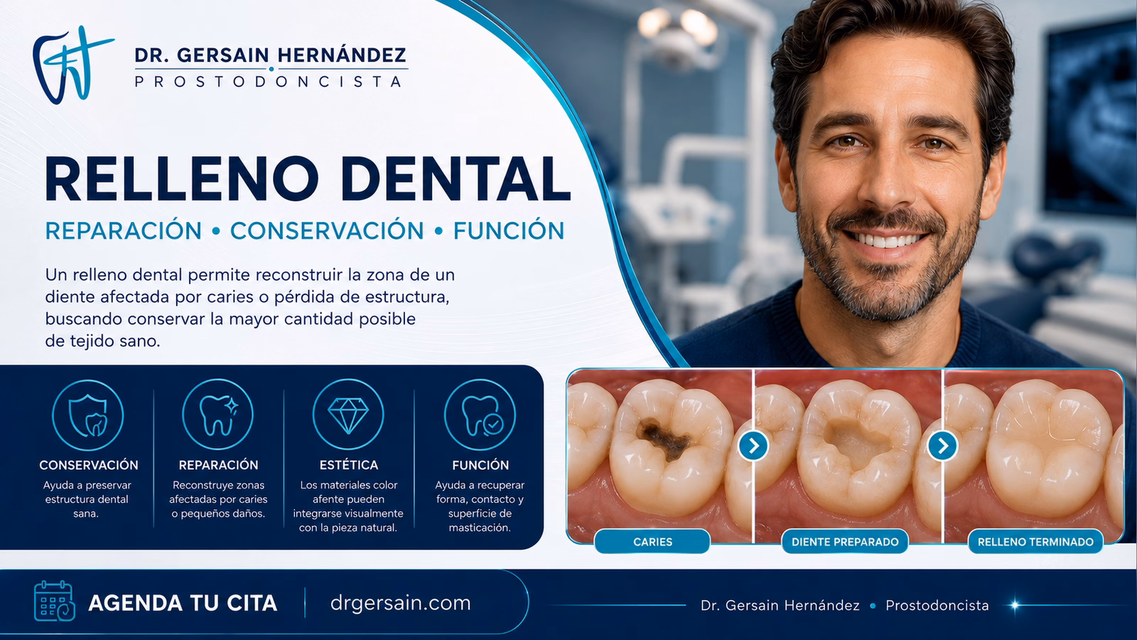 Relleno dental: qué es una obturación y qué materiales se utilizan