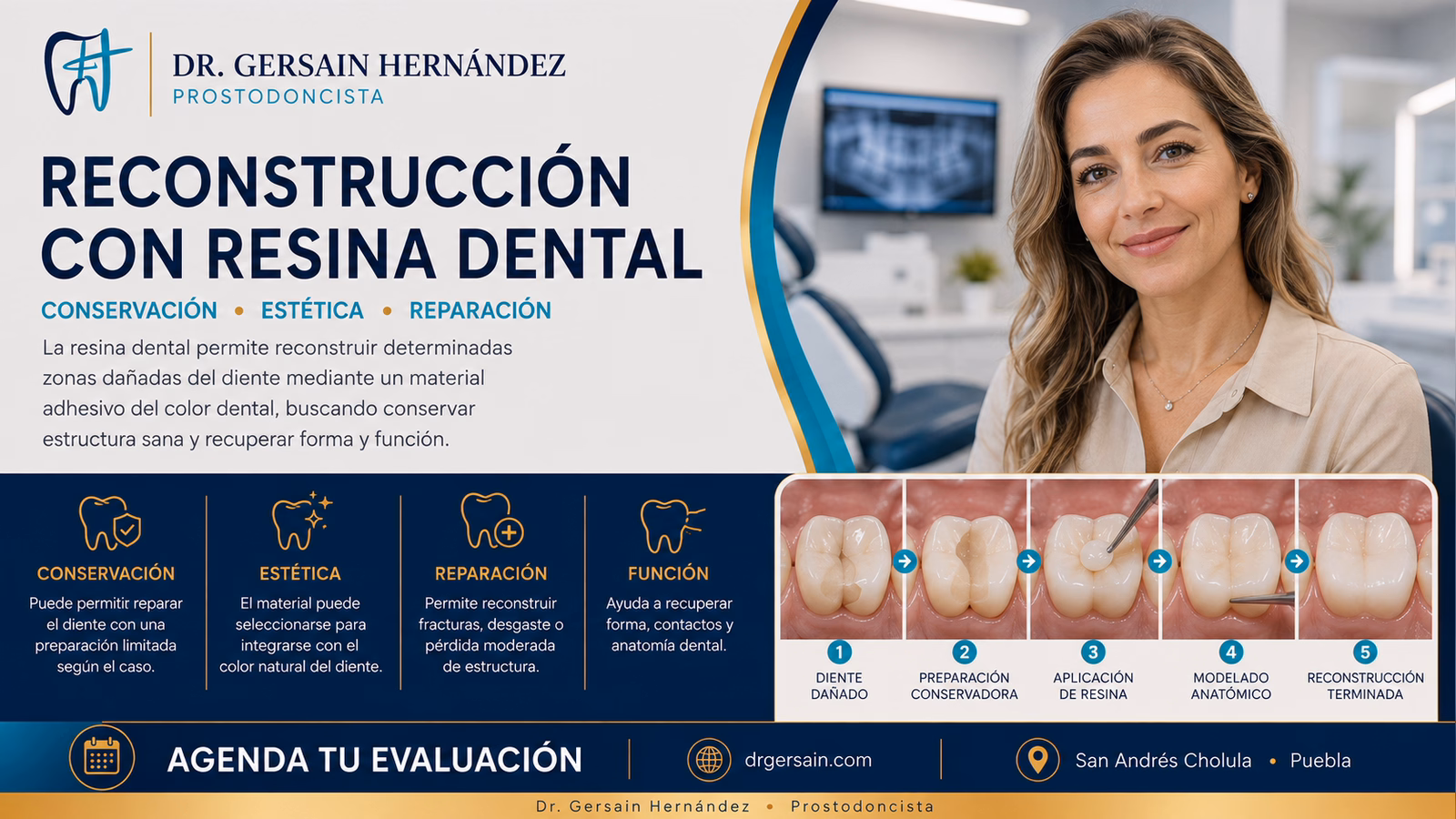 Resina dental y reconstrucción con resina: cuándo puede reparar un diente
