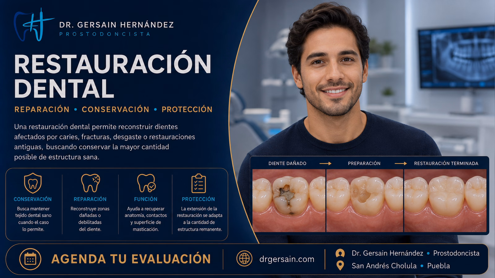 Restauración dental: opciones para reparar dientes dañados sin sobretratarlos