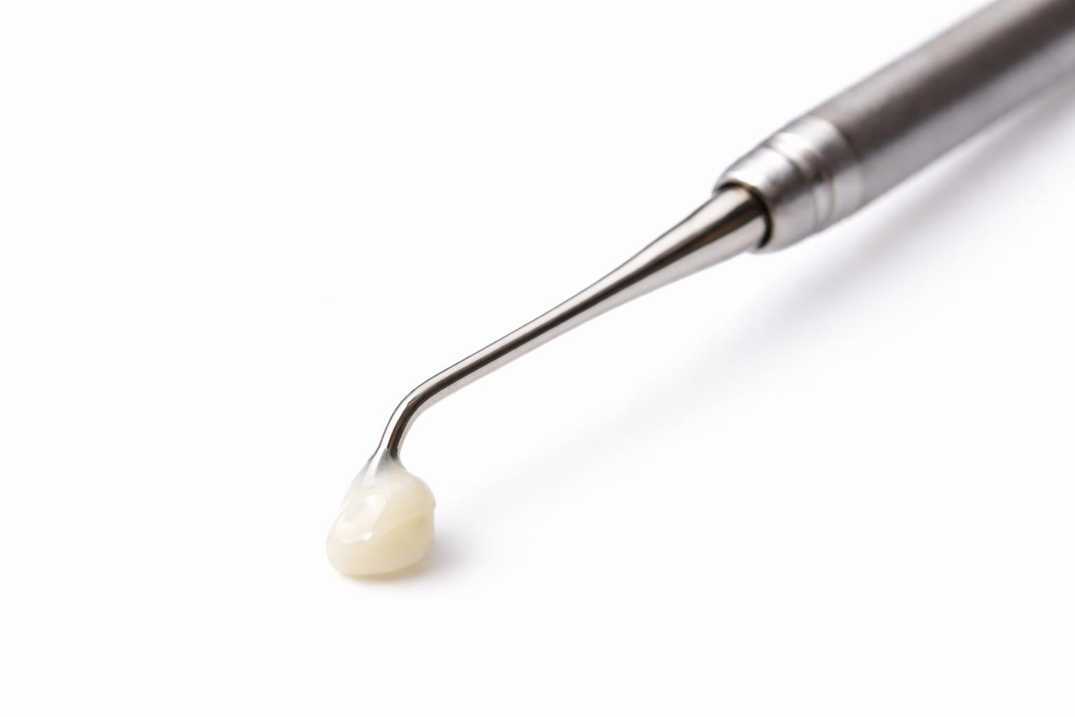Reparación estética dental con restauración natural
